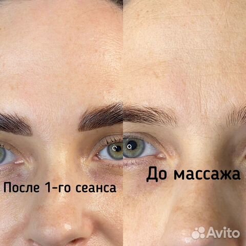 Массаж лица