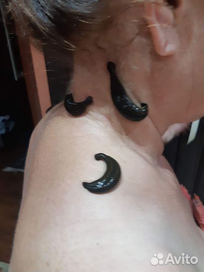 Пиявки медицинские