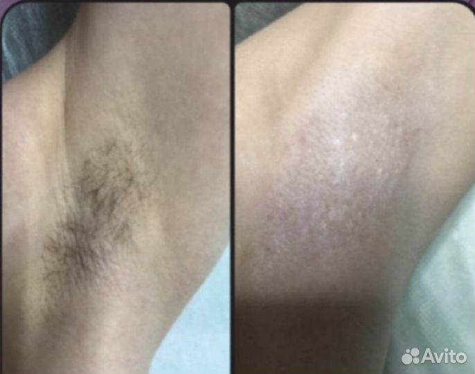 Спа-процедуры