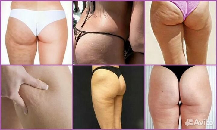 Лечебно-оздоровительный Массаж На дому