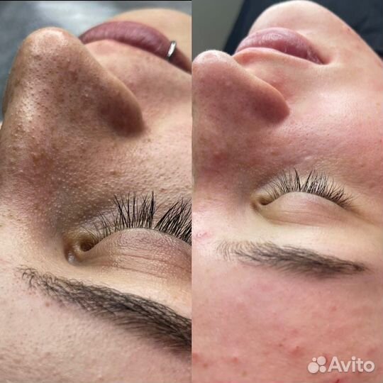 Услуги Косметолога