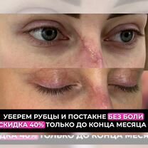 ❤︎ Apple Watch Series6 GPSモデル40mm