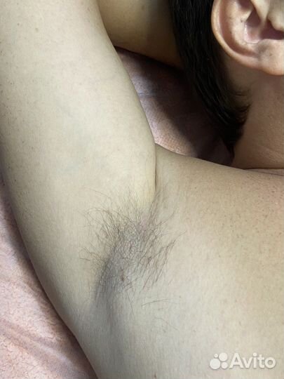 Мужская депиляция