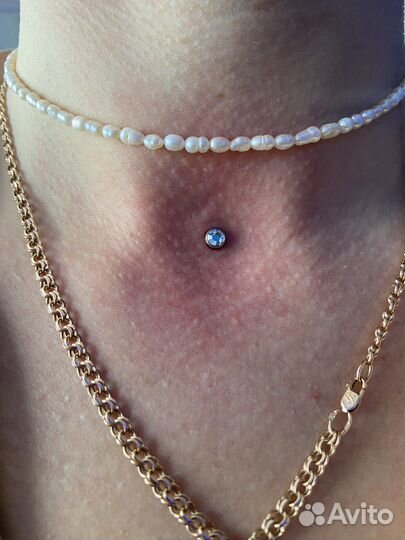 Модели на микродермалы