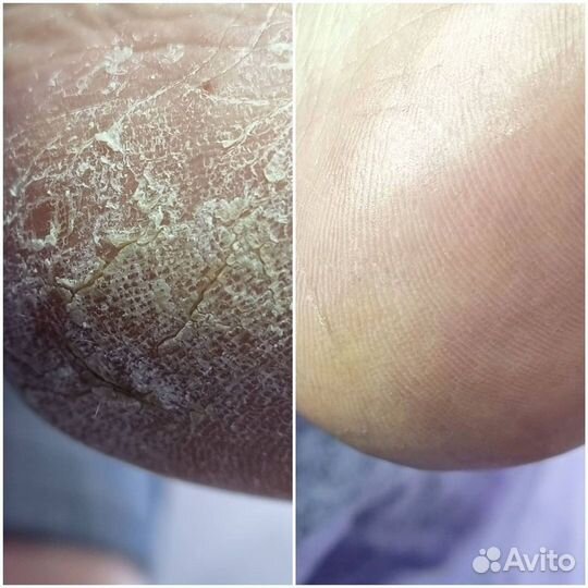 Подолог с медицинским образованием