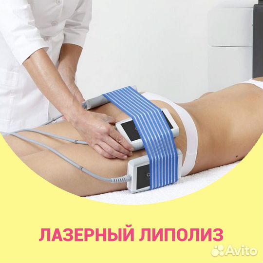 Модель на криолиполиз