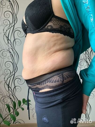 Моделирование фигуры и Умная подтяжка лица