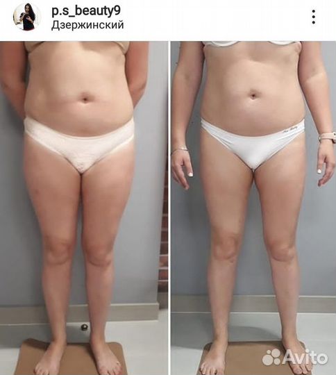 Массаж. Детский массаж