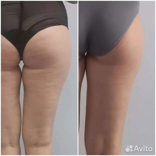 Косметолог, массаж, пилинг, чистка, аппарат массаж