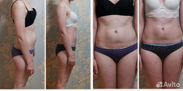 Массаж (коррекция фигуры) Только женщины