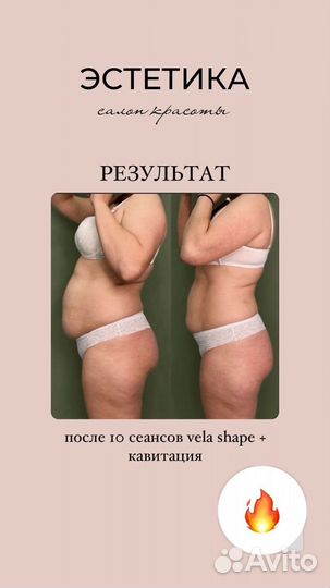 Аппаратная коррекция фигуры