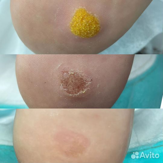 Услуги Подолога 49-39-29