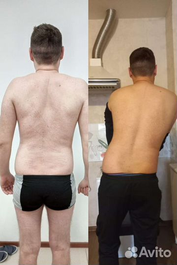 Услуги костоправа