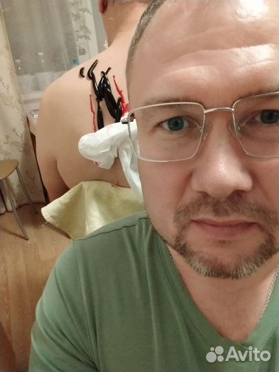 Остеопат,Мануальный терапевт, Иголки, Пиявки, масс