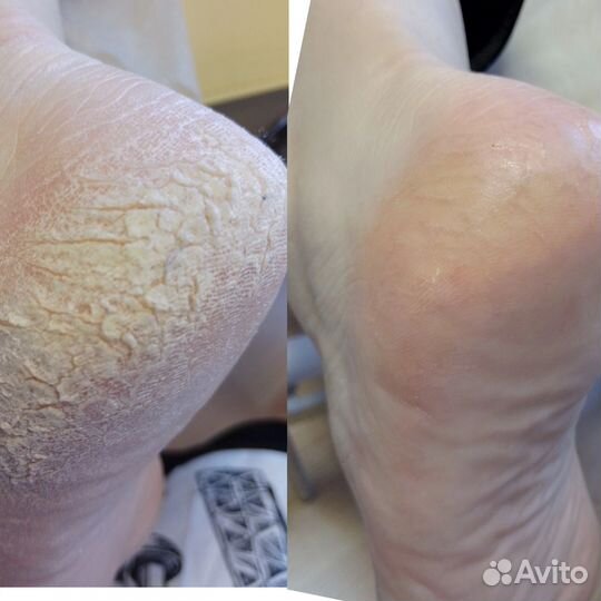 Услуги подолога