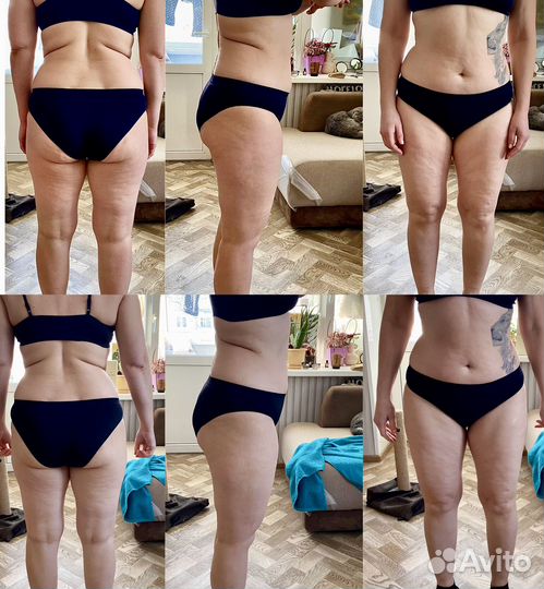 Массаж коррекция фигуры