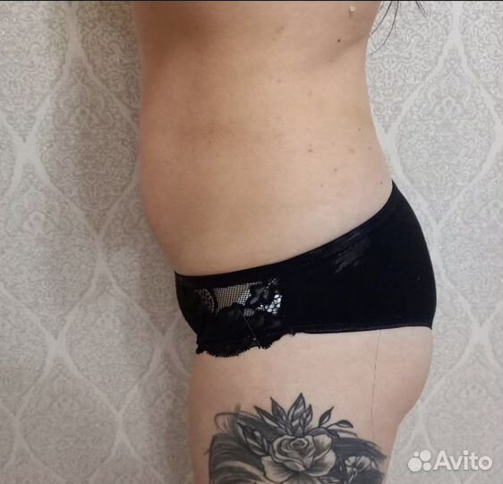 Аппаратный массаж