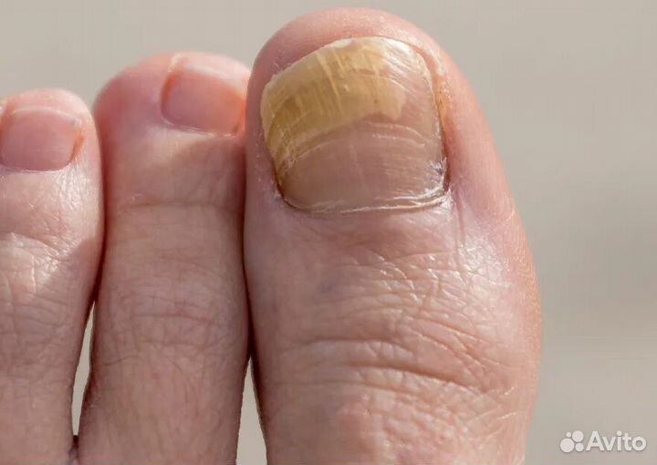 Модель на педикюр