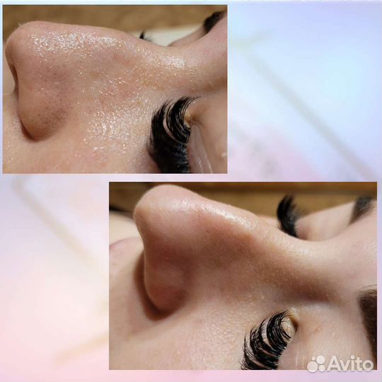 Услуги косметолога