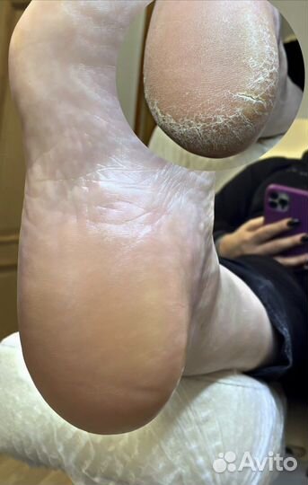 Смарт педикюр. Smart. Маникюр с гель лаком