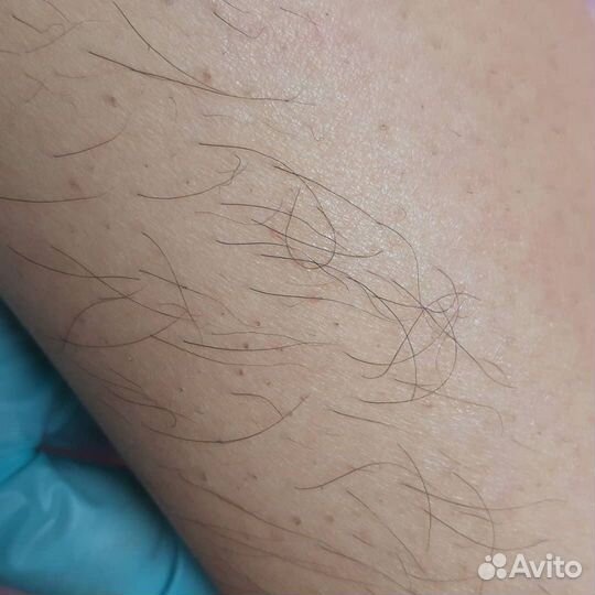 Эпиляция Воск