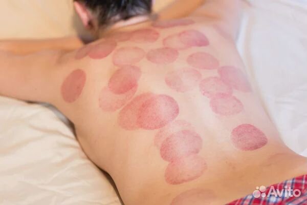 Массаж баночный