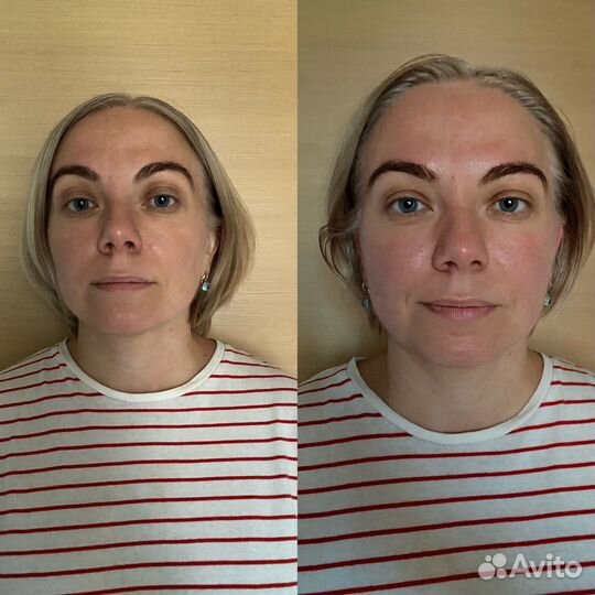 Массаж лица