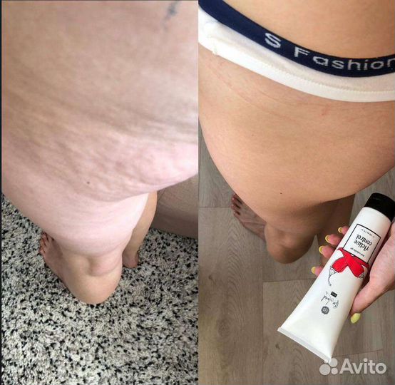 Антицеллюлитный крем