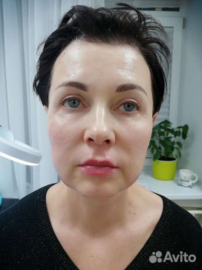 Лифтинг молодости 