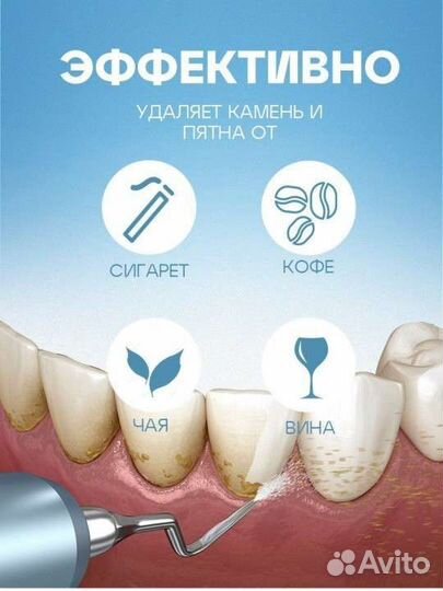 Ультразвуковой скалер для зубов