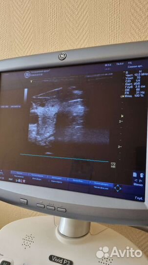 Аппарат узи