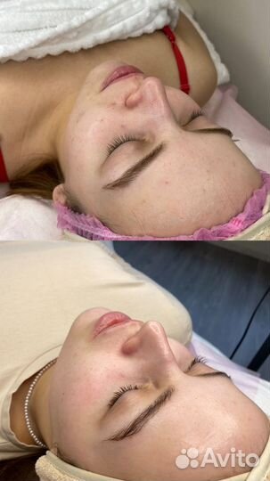 Услуги косметолога