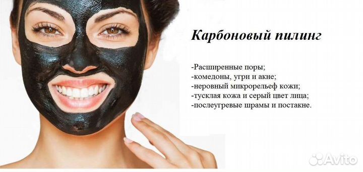 Карбоновый пилинг
