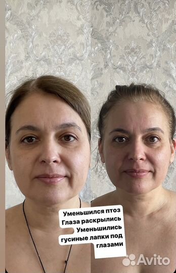 Массаж лица остеопатический