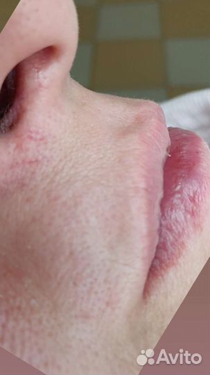 Депиляция воском