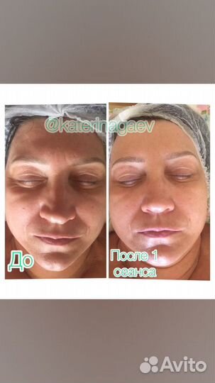 Fohow Биоэнергомассажер 3.0 Аппарат для массажа