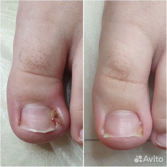 Желудочный сок гюрзы 10%