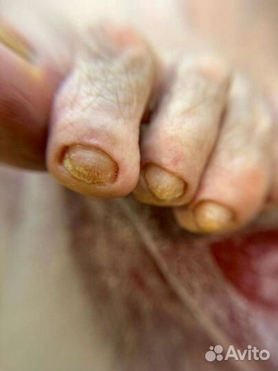 Подолог, есть выезд лечебный Педикюр грибок