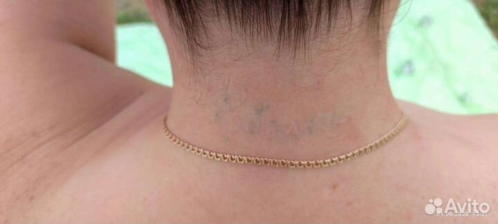 Удаление татуажа лазером модели