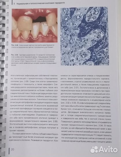 Регенерация пародонта