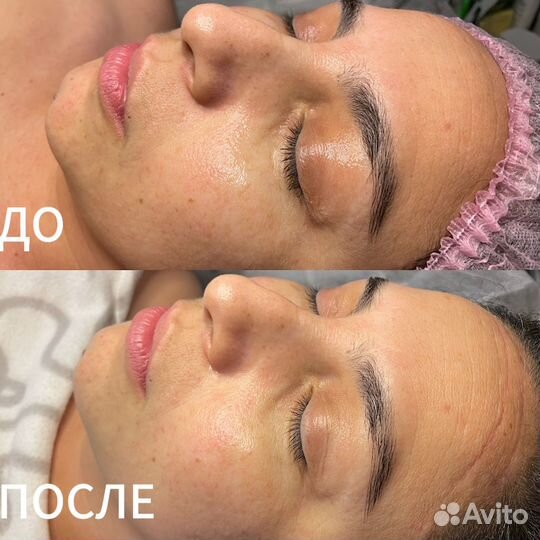 Косметолог пятигорск