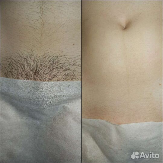 Наталья Шугаринг/Ваксинг