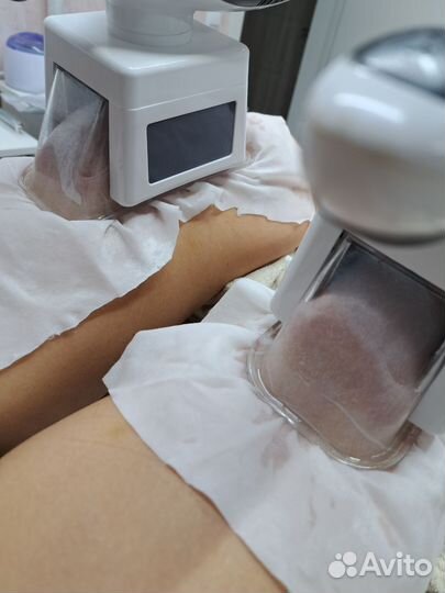 Криолиполиз