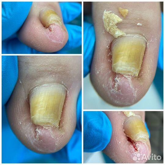 Подолог, мастер педикюра