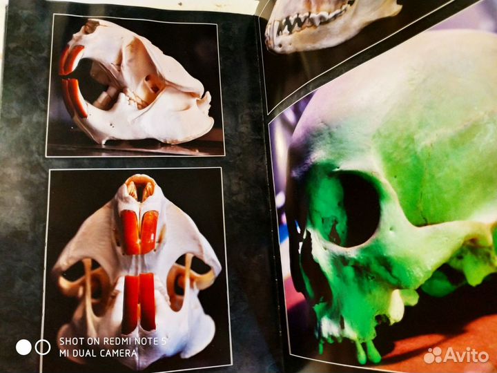 Cranial Visions: Exploring the Skull Through Art