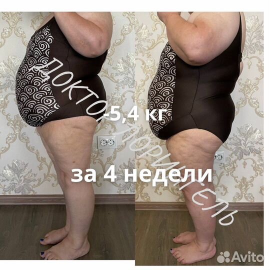 Выравнивание ногтевой пластины