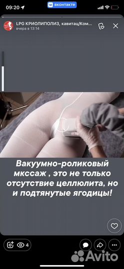 Криолиполиз, LPG, вакуумный массаж, прессотерапия