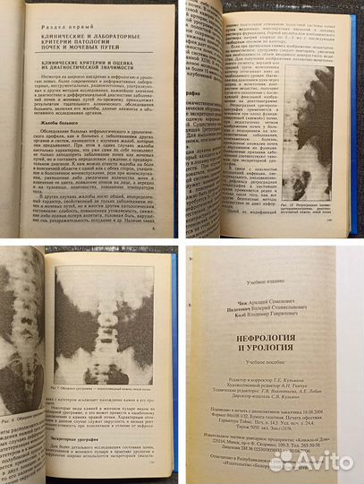 Нефрология и урология. Чиж. 2004