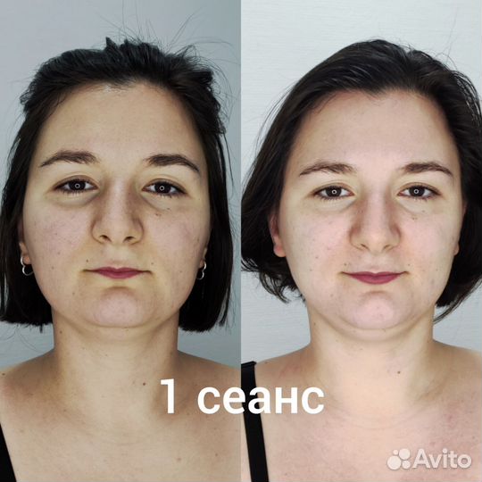 Миофасциальный массаж лица омоложение