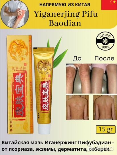 Китайская чудо мазь PifuBaodian от псориаза